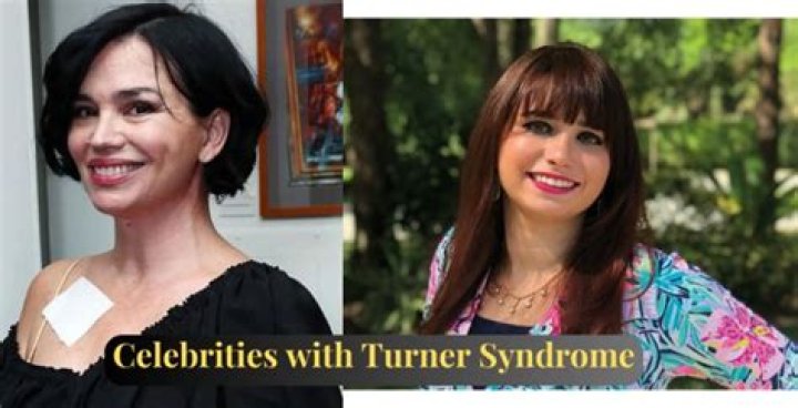 Celebrities With Turner Syndrome: Unlocking Discoveries And Insights