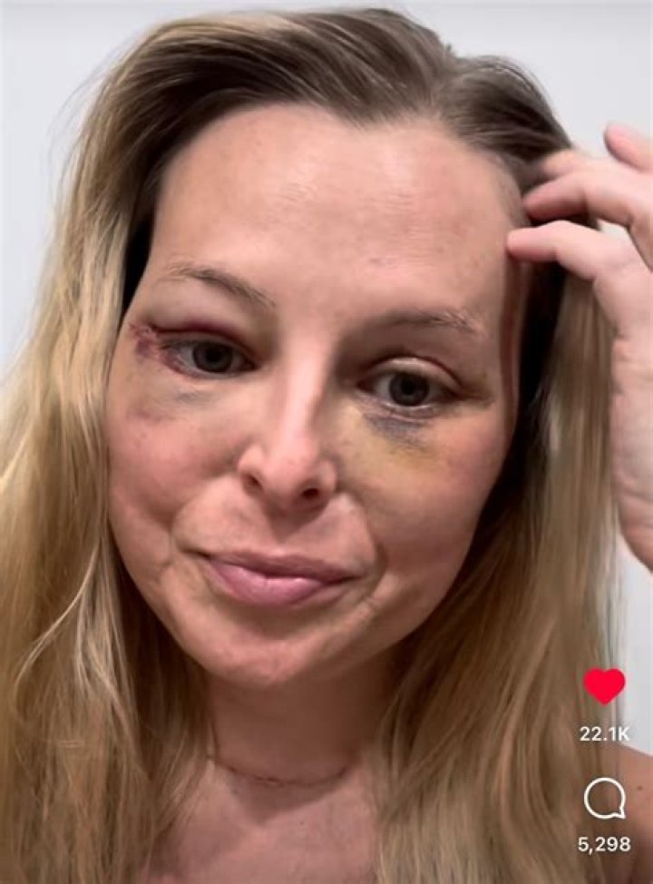 Cristy Lee’s Serious Health Issues. Health Update