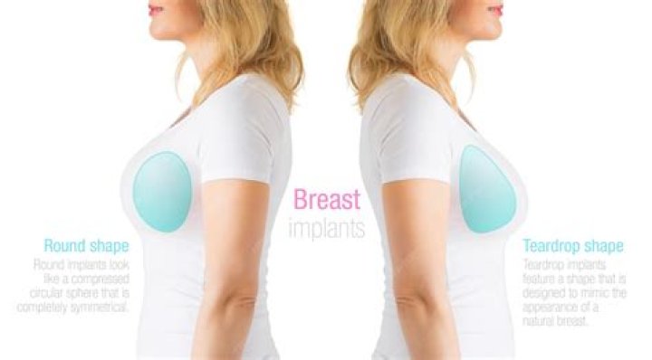 The Surprisingly Weird History Of Breast Implants
