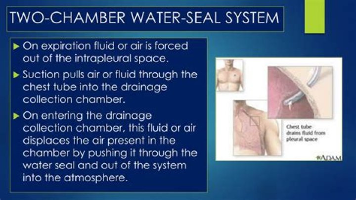What does continuous bubbling in the water seal chamber of a chest tube mean?